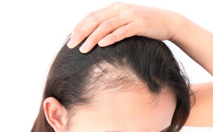 menopause-hair-loss-medication menopause-hair-loss-medication