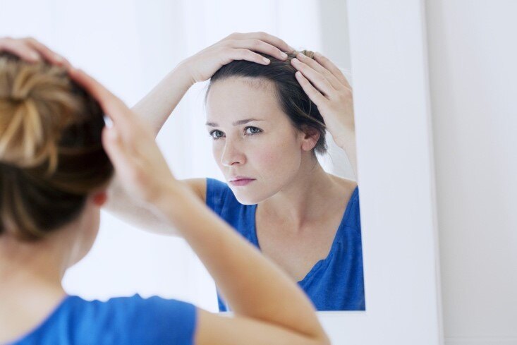 menopause-hair-loss menopause-hair-loss